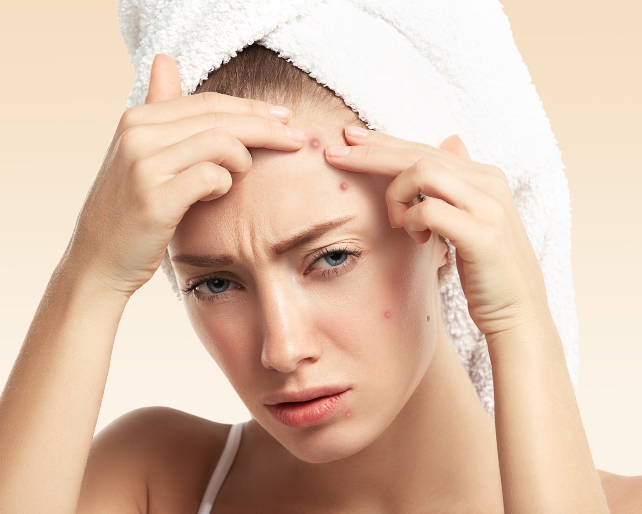 Pryszcze na czole - jakie są przyczyny i jak się pozbyć trądziku na czole?